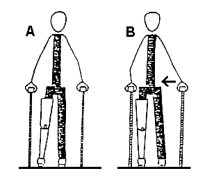 Early Gait Training