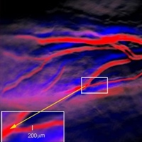 OU Health Sciences Tests Revolutionary Imaging Technique for Pancreatic Cancer
