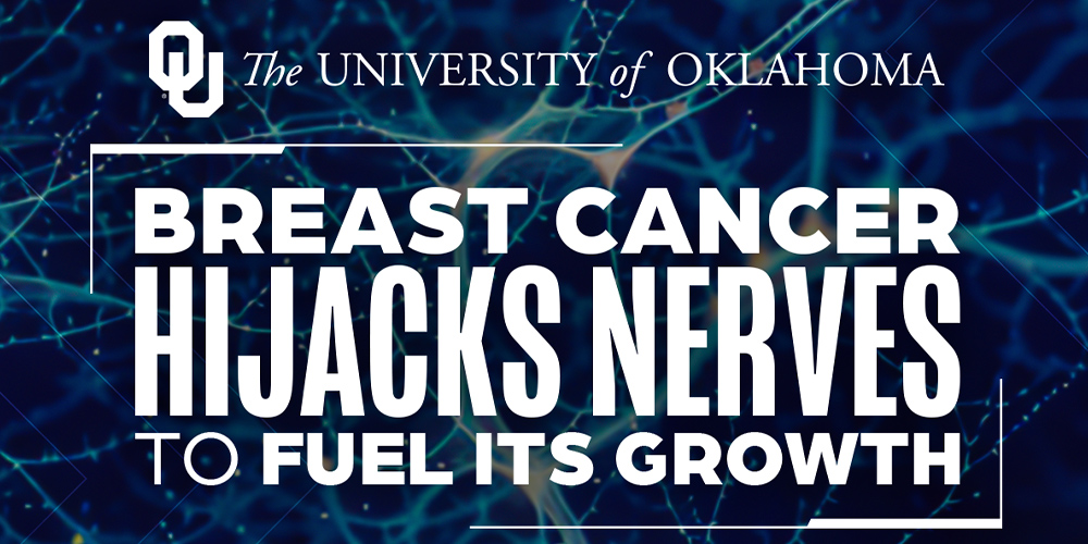 Researchers Discover How Tumors Enlist Nerves to Keep Growing