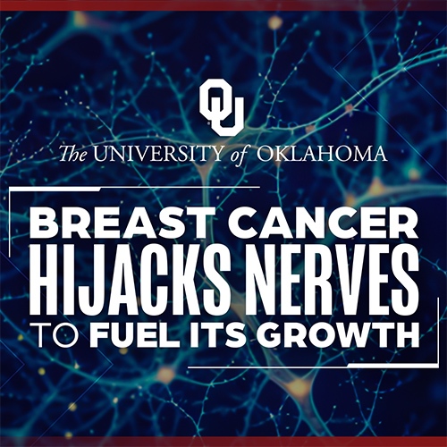 Researchers Discover How Tumors Enlist Nerves to Keep Growing