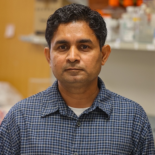 $2 Million NCI Grant Funds Research on How Pancreatic Cancer Uses Cholesterol to Survive