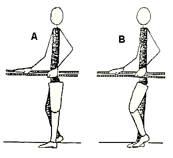 Early gait training