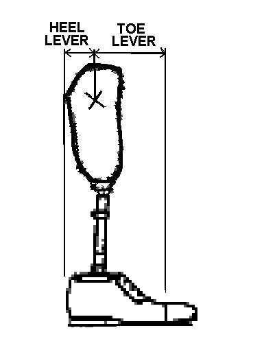 Extending the Below-knee (BK) socket