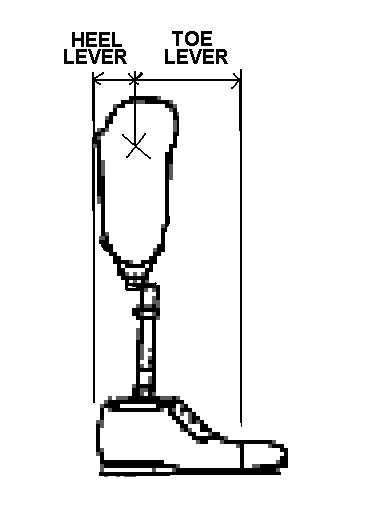 posterior placement of socket w/r/t foot