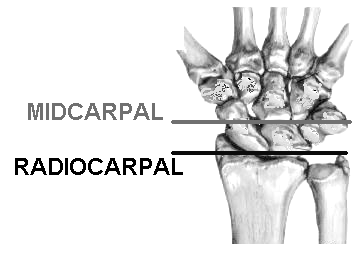 ap view of wrist complex