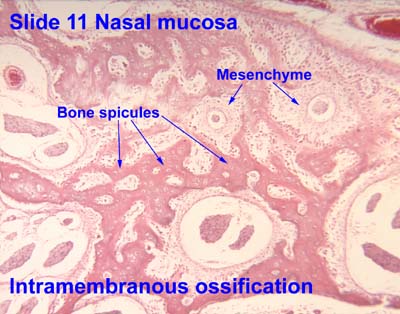 intramembranous ossification vs endochondral ossification