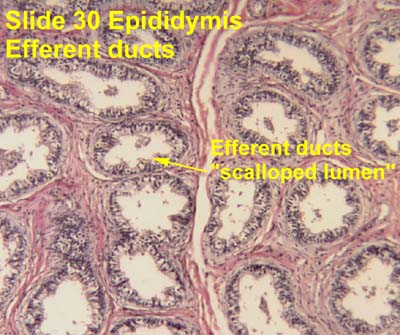 ductus epididymis histology