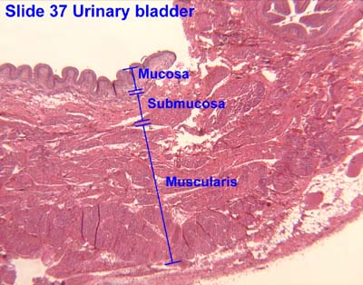kidney slide labeled