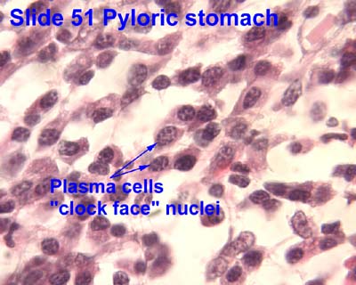 plasma cells histology