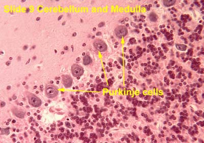 purkinje cell histology