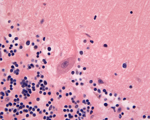 purkinje cell histology
