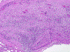 Com308-1-Ganglion-SM1.gif (129208 bytes)