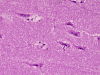 Com308-1-Hippocampus-HM1.gif (182189 bytes)