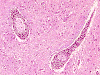 Com308-1-Medulla-LM1.gif (102215 bytes)