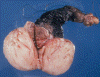 Com308-2-Gross.jpg (83789 bytes)